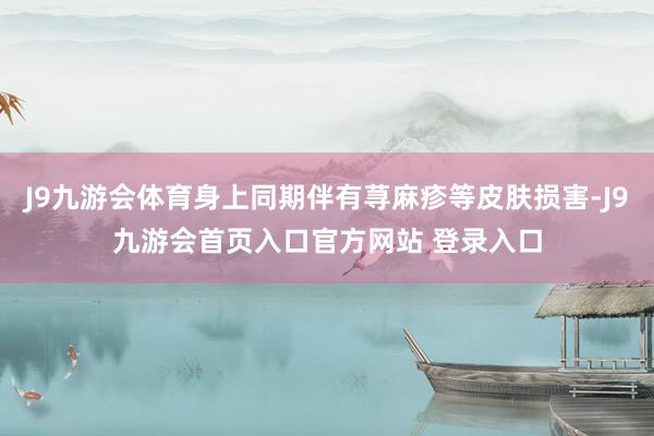 J9九游会体育身上同期伴有荨麻疹等皮肤损害-J9九游会首页入口官方网站 登录入口